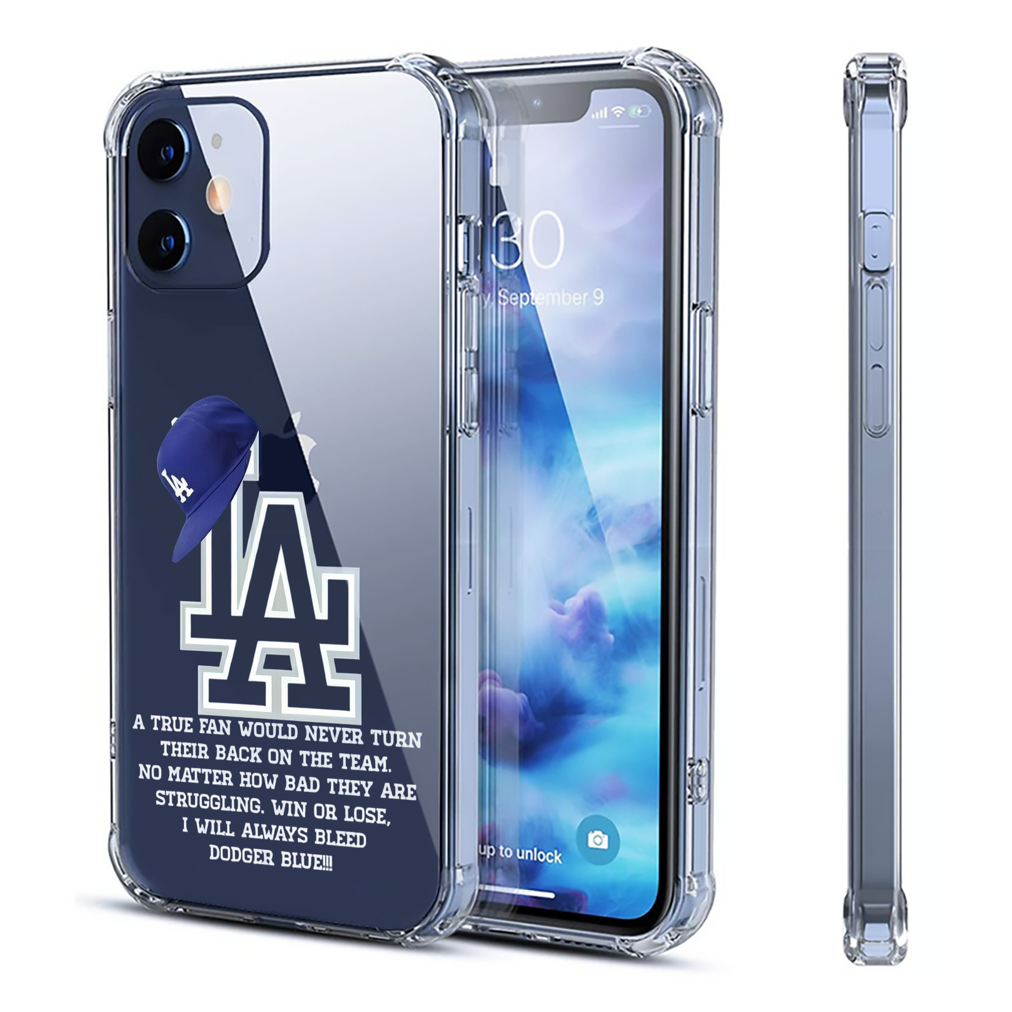  Clear IPhone 12 Case – Soft TPU With UV Print – Enhanced Drop Protection, Precise Fit, Anti-Fingerprint, Customizable Design, Scratch-Resistant, Yellow-Resistant